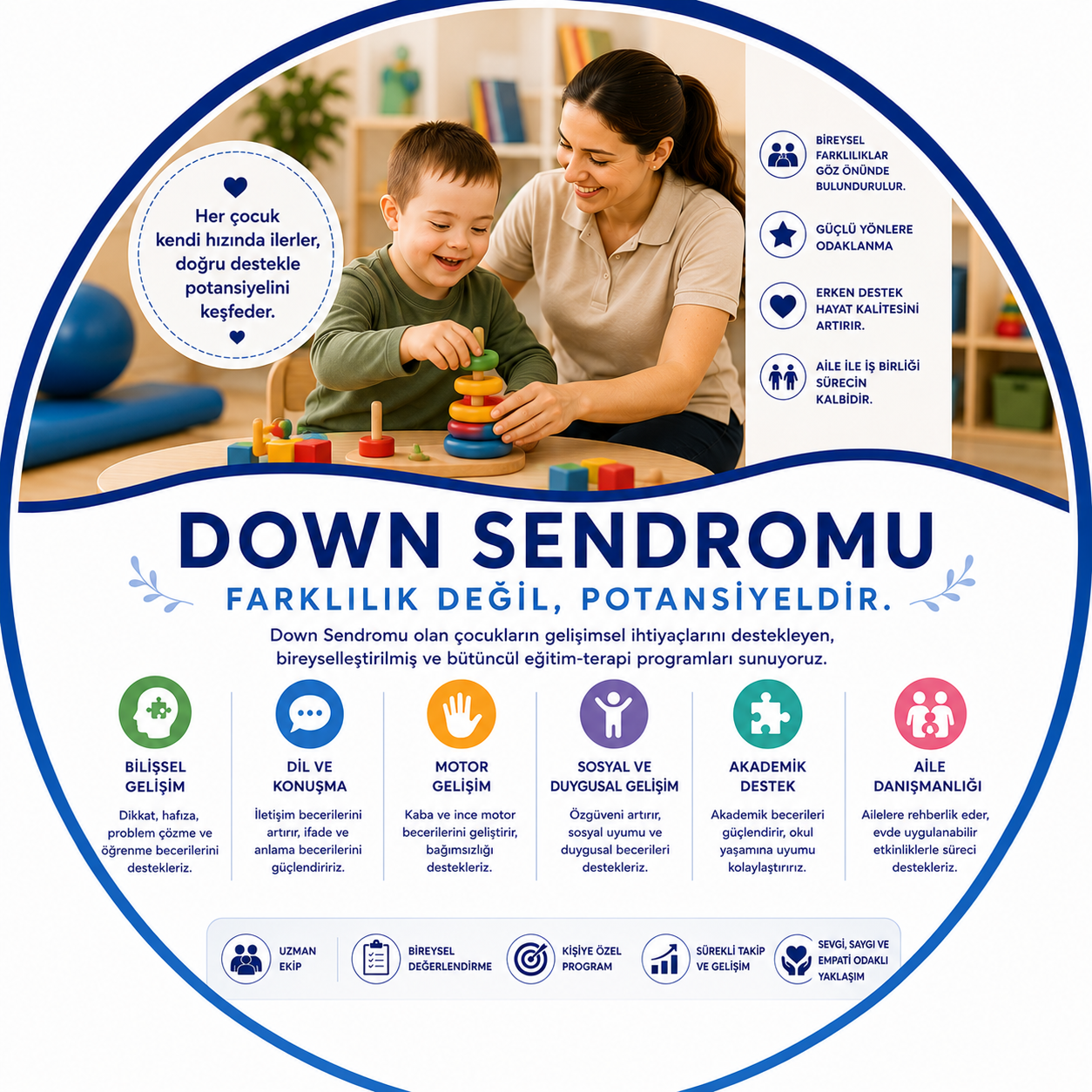 Down Sendromu